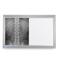 Negatoscopio Fluorescente de 2 Campos en Acero Integro